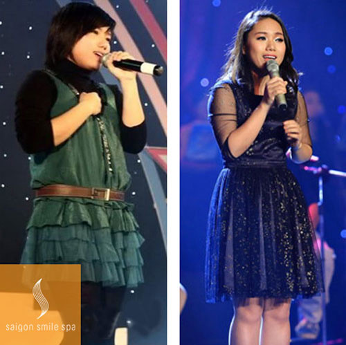 Trong số đó, việc giảm cân là điều quan trọng nhất. Nó giúp thân hình và gương mặt cô trở nên thon gọn, đường nét hơn.