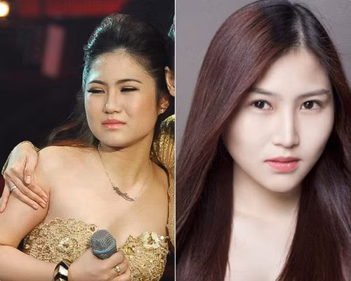 Hương Tràm đã từng không dám thừa nhận việc nâng mũi của mình.