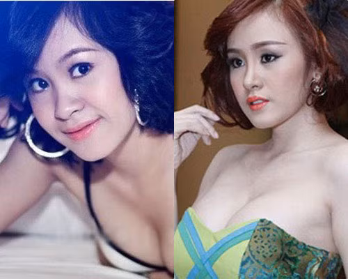 Bà Tưng trông quyến rũ hơn với chiếc mũi cao.