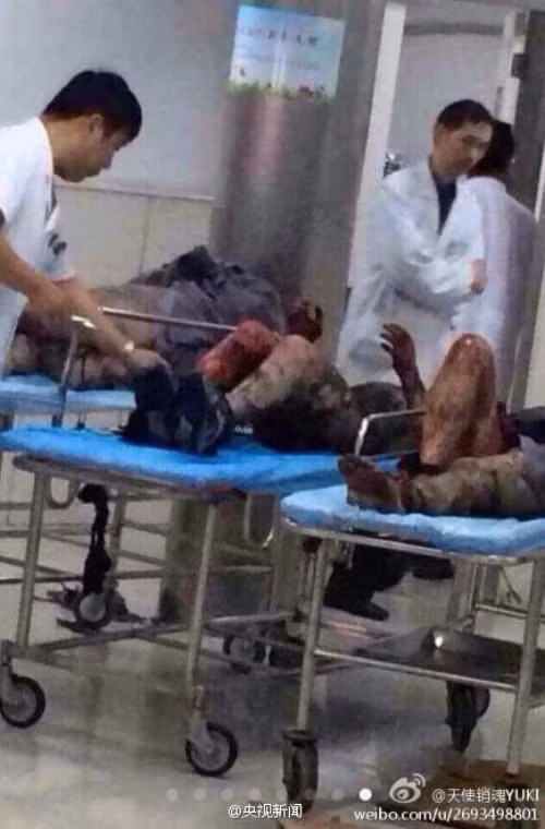 CÓ kỏoảng 450 nhân công làm việc trong nhà máy khi vụ nổ xảy ra.