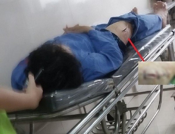 Đối tượng đâm cán bộ Cục thuế Ninh Bình khai gì tại cơ quan Công an? Doi tuong dam can bo Cuc thue Ninh Binh khai gi tai co quan Cong an?