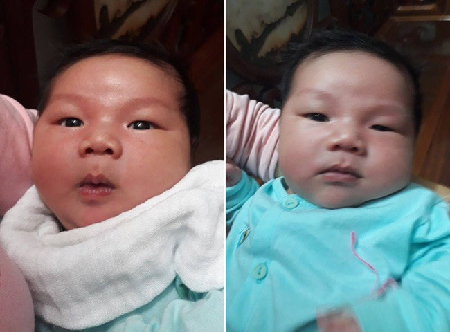 Em be so sinh chao doi voi can nang ky luc 7,1kg, gio ra sao?