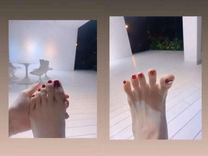 Những sao nữ nổi tiếng xinh đẹp, quyến rũ nhưng cũng có những khuyết điểm khó khắc phục - Hình 7 Nhung sao nu noi tieng xinh dep, quyen ru nhung cung co nhung khuyet diem kho khac phuc-Hinh-7