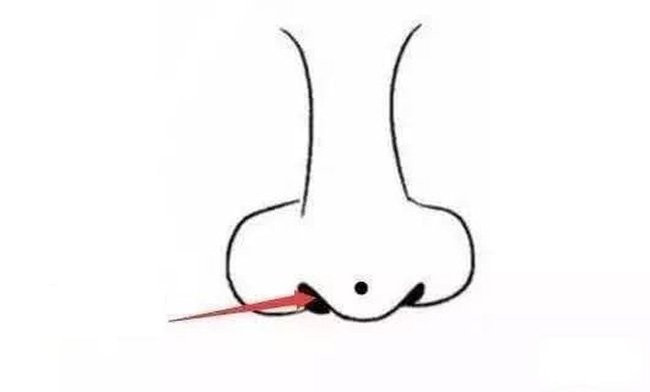 3 nốt ruồi cực phẩm cả đời chẳng lo túng thiếu 3 not ruoi cuc pham ca doi chang lo tung thieu