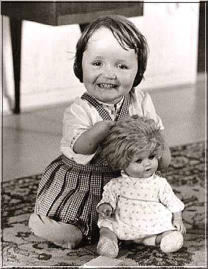 Để thể hiện sự hối tiếc của mình, hãng dược này còn khánh thành tượng đồng có hình một em bé bị dị dạng, không chân tay. Tuy nhiên, lời xin lỗi của Gruenenthal được cho là quá muộn màng.