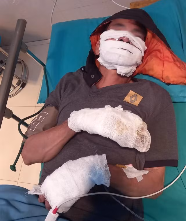 Dien thoai sac qua dem phat no khien hai nguoi bong nang