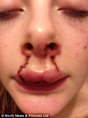 Các thẩm phán kết luận Rhys Culley tấn công người có chủ đích và khẳng định nam thanh niên này sẽ phải ngồi tù.