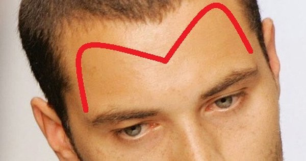 5 tướng trán của người sớm muộn cũng giàu, có căn làm sếp - Hình 3 5 tuong tran cua nguoi som muon cung giau, co can lam sep-Hinh-3