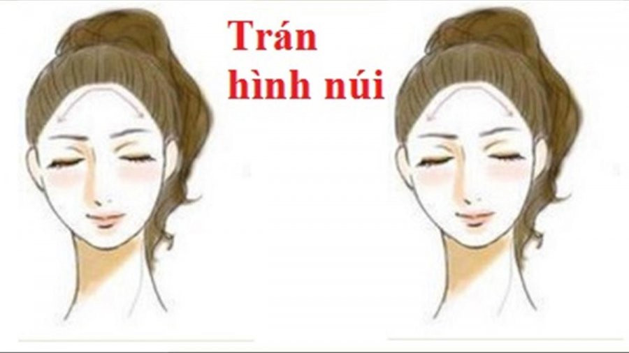 5 tướng trán của người sớm muộn cũng giàu, có căn làm sếp - Hình 2 5 tuong tran cua nguoi som muon cung giau, co can lam sep-Hinh-2