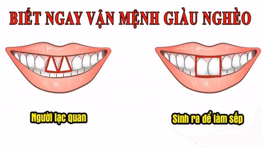 4 tướng răng của người vượng khí cả đời tiêu không hết của 4 tuong rang cua nguoi vuong khi ca doi tieu khong het cua