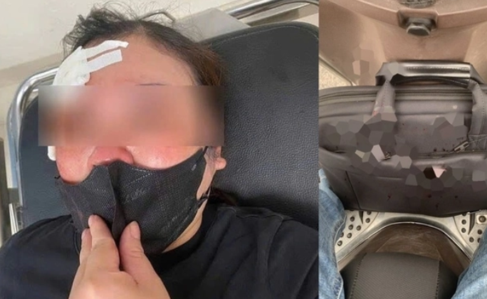 Nguyen nhan vu nguoi phu nu di xe may bi danh vao dau