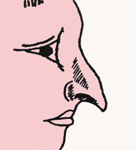 Phần đầu mũi không có thịt, nhọn và hướng xuống dưới được gọi là mũi chim ưng. Những người có dạng mũi này thường rất thâm hiểm, ác độc, thích bày mưu tính kế, hãm hại người khác. 