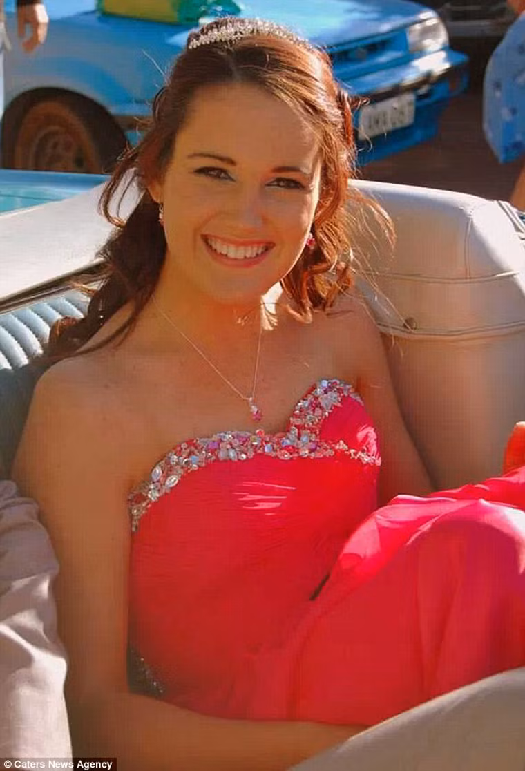 Sự việc xảy ra đúng ngày sinh nhật 19 tuổi của Heron. Lúc đó, người thân cô vô lo lắng khi chứng kiến sự đau đớn mà Heron phải chịu đựng. Từng lớp da của bệnh nhân trở nên phỏng rộp, bong ra trong khi mặt sưng phù.