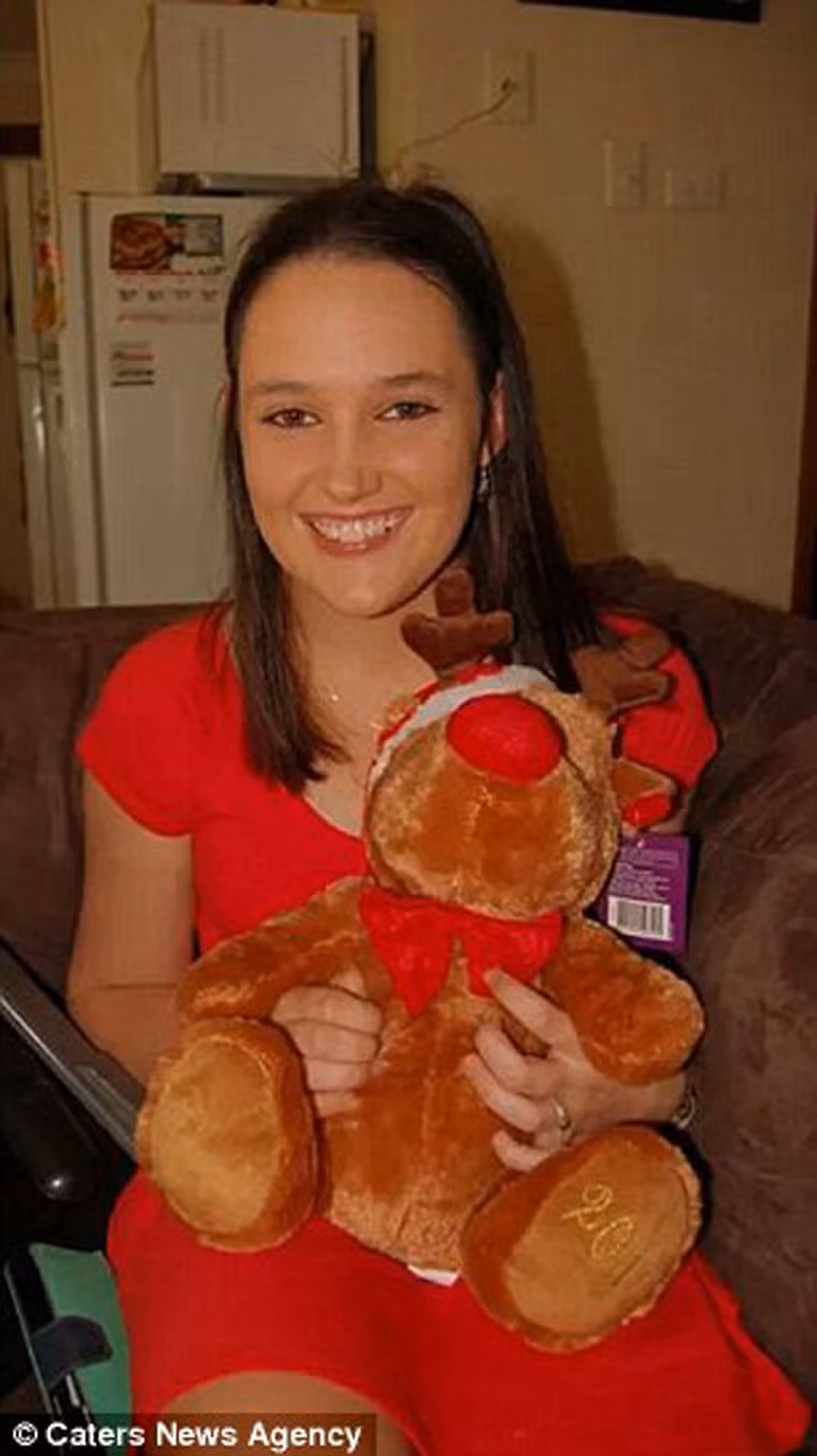 Heron phải nằm viện một tháng để điều trị. Những lúc nguy cấp, Heron buộc phải thở oxy, sử dụng ống nuôi để đưa thức ăn vào cơ thể. Hình ảnh thiếu nữ xinh đẹp của cô không còn nữa thay vào đó khi rời viện, tóc, ngón tay, ngón chân Heron thi nhau rụng. Mắt của cô gái cũng luôn trong tình trạng khô rát và thân hình dày đặc vết sẹo.