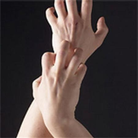 Cảm giác ngứa thường trực. Cảm giác ngứa ở bệnh nhân ung thư xảy ra khi chức năng gan suy giảm mạnh, lượng bilirubin trong máu tăng. Trong khi đó, lượng bilirubin tăng được xem là yếu tố gây ngứa ngáy.