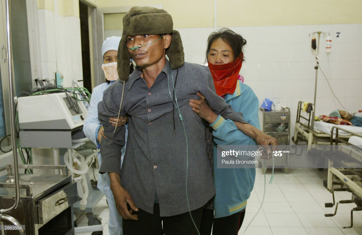 Một nam bệnh nhân nghi nhiễm cúm gia cầm được người nhà và y tá trợ giúp di chuyển trong phòng bệnh, 20/1/2004.