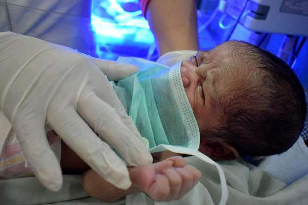 Chao doi giua dich, cap song sinh duoc dat ten “Corona” va “Covid”