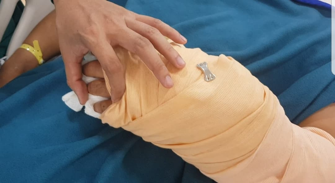 Nan nhan bi chem lia tay ke lai giay phut bi truy sat tren pho Sai Gon