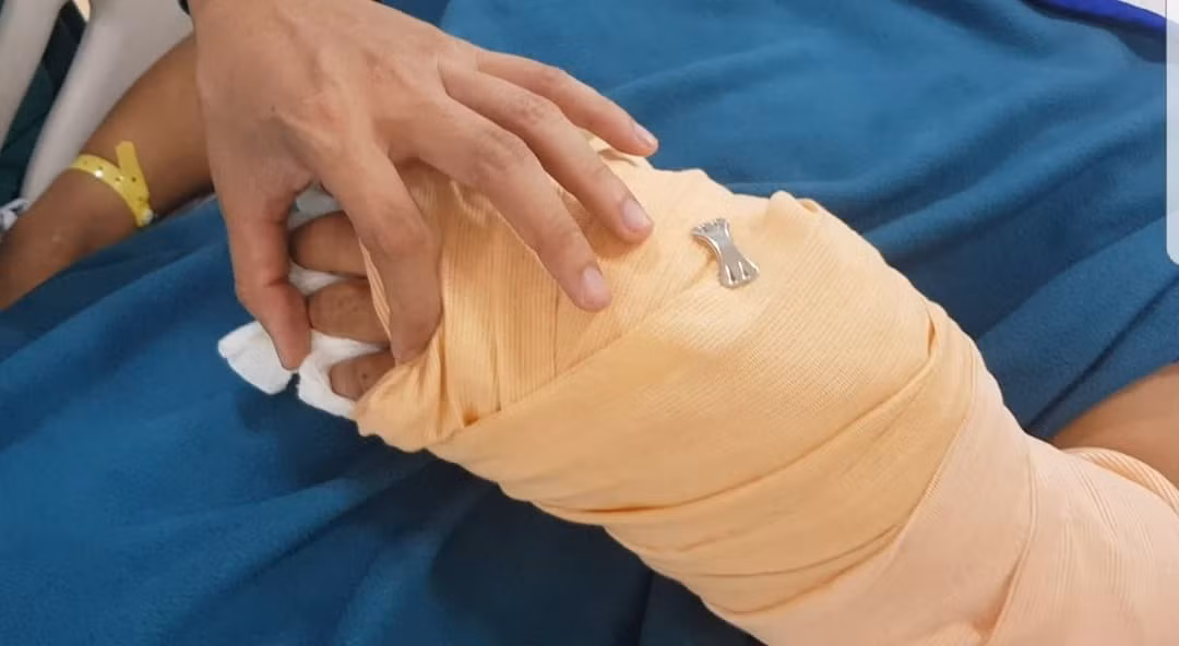 Nan nhan bi chem lia tay ke lai giay phut bi truy sat tren pho Sai Gon