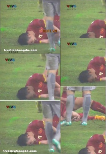 Trong trận bán kết lượt đi AFF Cup 2014 mới đây, tình trạng CĐV Malaysia chiếu đèn laser vào các cầu thủ lại một lần nữa tiếp diễn. Không chỉ Việt Nam mà nhiều đội bóng khác trong khu vực Đông Nam Á cũng từng phàn nàn, kiến nghị vì bị CĐV Malaysia gây tác động xấu.