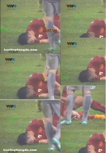 Trong trận bán kết lượt đi AFF Cup 2014 mới đây, tình trạng CĐV Malaysia chiếu đèn laser vào các cầu thủ lại một lần nữa tiếp diễn. Không chỉ Việt Nam mà nhiều đội bóng khác trong khu vực Đông Nam Á cũng từng phàn nàn, kiến nghị vì bị CĐV Malaysia gây tác động xấu.