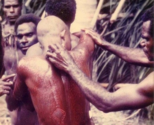 Nghi lễ rạch cơ thể ở Papua New Guinea. Các bộ tộc sống dọc sông Sepik ở Papua New Guinea sẽ tham gia một nghi lễ truyền thống, rạch cơ thể để đánh dấu sự trưởng thành.