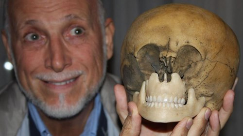 Theo những kiến thức y khoa mới nhất, các khuyết tật bẩm sinh ở vùng chẩm và đỉnh đầu rất khó có khả năng xảy ra bởi cấu trúc đối xứng tồn tại trong tất cả các vùng ở hộp sọ người. Ở hộp sọ "Starchild", cấu tạo xương ở hai hốc mắt có những vùng lõm và vùng lồi cực kỳ tinh tế và rất cân xứng. Chắc chắn chúng được hình thành trên phương diện gen chứ không phải bởi dị dạng.