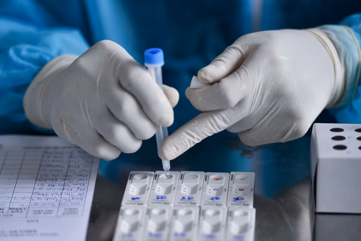 TP HCM thay doi chien luoc xet nghiem, tang toc do tim F0-Hinh-2