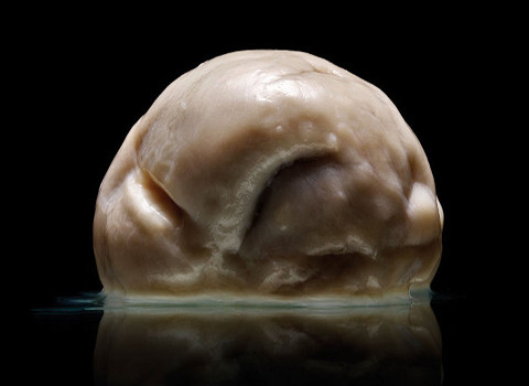 Bộ não đặc biệt nhất thế giới: hoàn toàn phẳng lì, không nếp gấp.