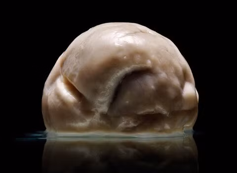 Bộ não đặc biệt nhất thế giới: hoàn toàn phẳng lì, không nếp gấp.