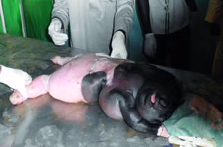 Hàng ngàn người hiếu kỳ đã kéo đến bệnh viện thú y Fakon Idi Veterinary ở Nigeria để xem một tạo vật nửa người nửa cừu. Các bác sĩ thú y đã phát hiện ra quái thú từ bào thai của cừu mẹ và quyết định mổ để giúp cừu mẹ sinh nó ra.