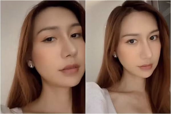 Sau hơn 1 tháng với quyết định sửa dáng mũi mới khác hoàn toàn trước kia, mới đây, nữ ca sĩ mới tự tin khoe cận gương mặt ngày càng nhuận sắc và nữ tính. Có thể thấy chiếc mũi của Lynk Lee đã thanh thoát hơn nhiều và không còn sưng nữa.