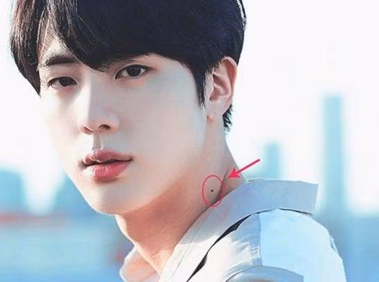 Not ruoi o co, co lo tien chon: Nam hay nu deu so huong-Hinh-3