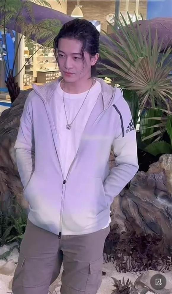 Harry Lu diện mạo thế nào sau tai nạn và 20 lần phẫu thuật? - Hình 2 Harry Lu dien mao the nao sau tai nan va 20 lan phau thuat?-Hinh-2