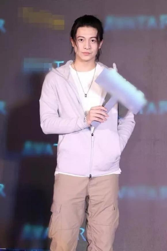 Harry Lu diện mạo thế nào sau tai nạn và 20 lần phẫu thuật? - Hình 3 Harry Lu dien mao the nao sau tai nan va 20 lan phau thuat?-Hinh-3