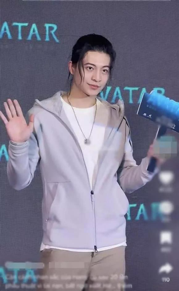 Harry Lu diện mạo thế nào sau tai nạn và 20 lần phẫu thuật? Harry Lu dien mao the nao sau tai nan va 20 lan phau thuat?