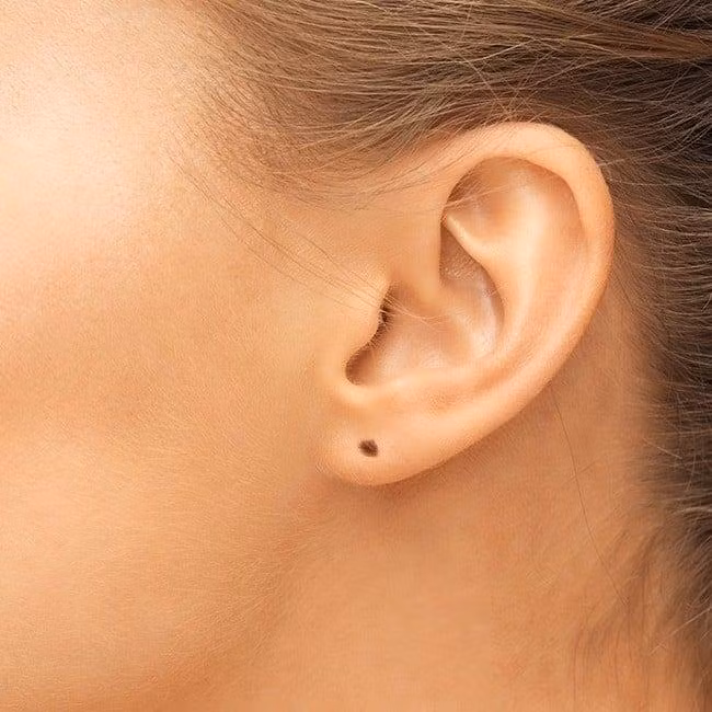 Nốt ruồi ở dái tai. Đây là nốt ruồi đạt cát trong nhân tướng học. Người có nốt ruồi này thường biết suy tính trước sau, tư duy logic, hành động cẩn trọng, tài vận hanh thông.