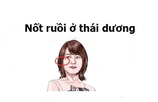 Nốt ruồi ở Thái Dương. Huyệt Thái Dương còn gọi là cung Dịch Mã. Theo nhân tướng học, đây là khu vực dự báo về việc di chuyển của bản mệnh, từ du lịch, công tác đến đi xa lập nghiệp...