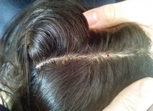 Người sở hữu nốt ruồi này có đời sống vật chất phong phú, không phải lo lắng về chuyện tiền bạc. Khi gặp khó khăn, họ sẽ được quý nhân ra tay giúp đỡ, con đường làm giàu ngày càng suôn sẻ.