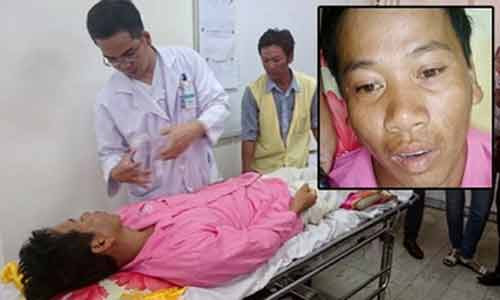 Anh Nam khóc khi nhớ về vụ tai nạn kinh hoàng khiến vợ chết, con trọng thương, bản thân anh mất đi một phần chân phải - Ảnh: Thanh Huyền. Anh Nam khóc khi nhớ về vụ tai nạn kinh hoàng khiến vợ chết, con trọng thương, bản thân anh mất đi một phần chân phải - Ảnh: Thanh Huyền.