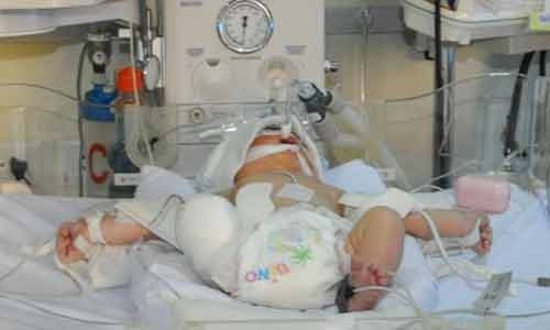 Bé trai tội nghiệp đang được chăm sóc, điều trị tích cực tại Nhi Đồng 1.