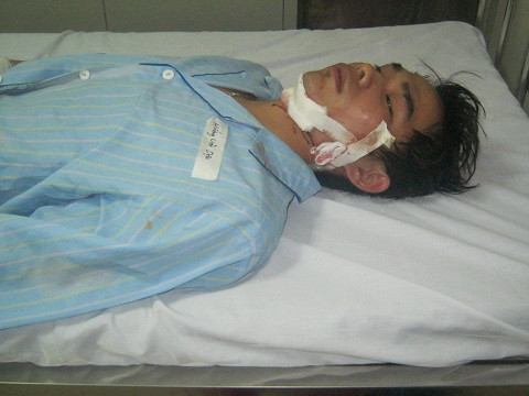 Nạn nhân bị thương trong vụ tai nạn lật xe.