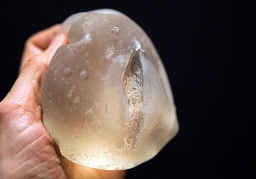 No tui nguc khi di may bay, bac si noi co no vo duoc khong, su thuc bat ngo