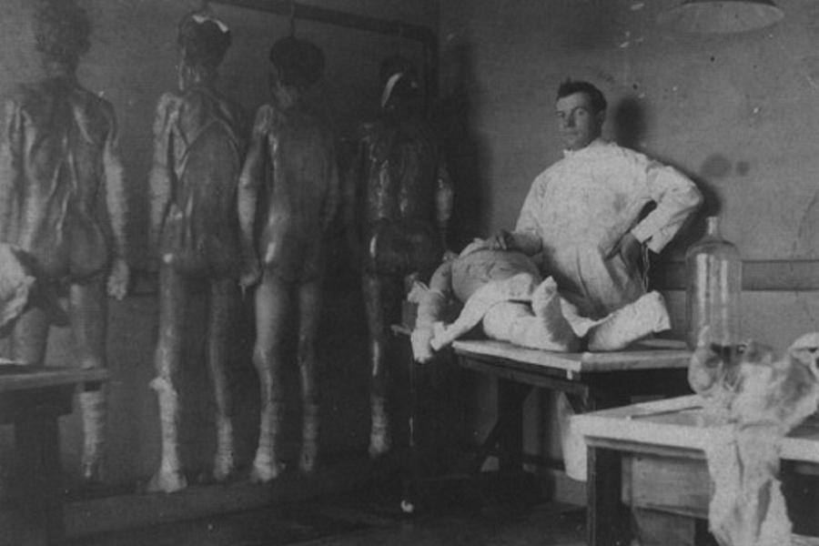 Cặp song sinh được biết đến nhiều nhất trong các thí nghiệm của Mengele hai anh em song sinh người Hungary, được gã bác sĩ "tử thần" chọn lựa vào năm 1943.