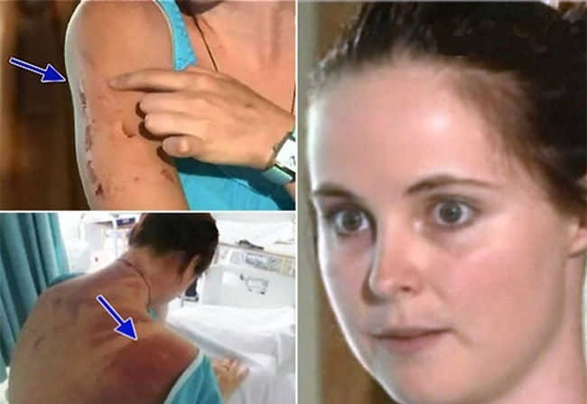 Năm 2012, sau cú nhảy mạo hiểm trên cầu Victoria, cô gái Erin Langworthy đã gặp nạn, khi chiếc dây dù của cô bị đứt. Cô rơi xuống sông, thật may mắn lúc đó không có con cá sấu nào. Dù chỉ bị một vài vết thương nhẹ nhưng Erin cũng được một phen kinh hãi.