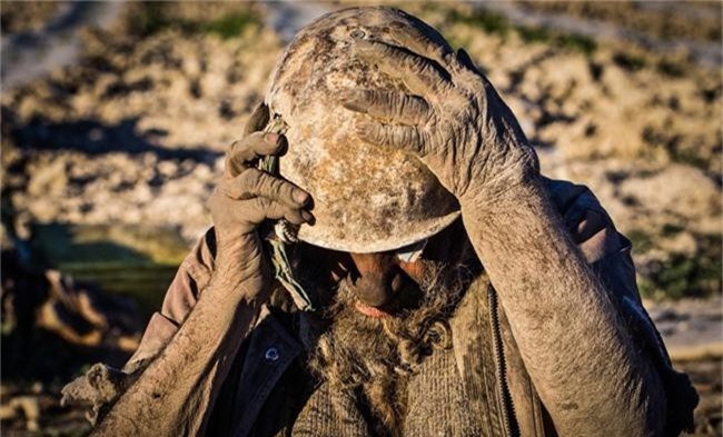 Sau khi xem hình ảnh, một số bình luận còn cho rằng tay chân ông sần sùi không khác những chú voi. 