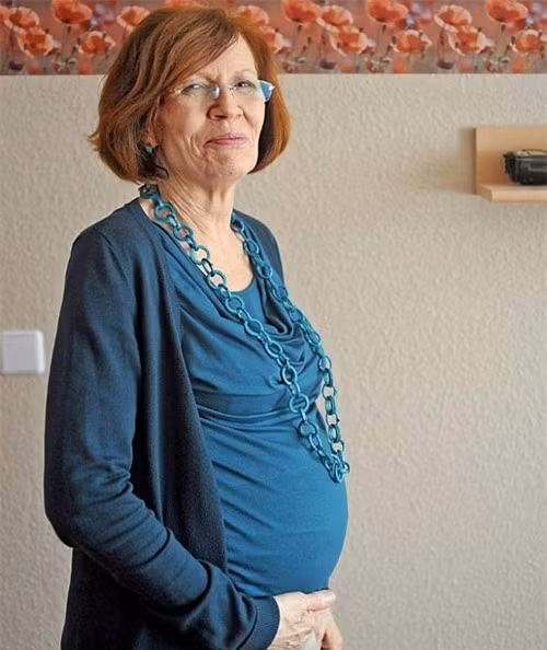 2. Bà mẹ già nhất mang thai bốn: Kỷ lục này được thiết lập mới đây dành cho mẹ Annegret Raunigk, là giáo viên tiếng Nga và tiếng Anh ở Berlin, Đức. Hiện tại bà đã có 13 người con và 7 đứa cháu. Lý do bà Annegret Raunigk quyết định có thêm con bởi con gái út 9 tuổi của bà muốn có thêm em trai hoặc em gái. Hiện con lớn nhất của bà đã 44 tuổi. Bà Annegret Raunigk đang mang thai tuần thứ 23. Trước đây, kỷ lục người phụ nữ cao tuổi nhất sinh bốn thuộc về bà Merryl Fudel ở tuổi 55.