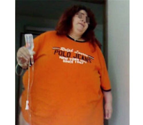 1. Người phụ nữ mang thai nặng nhất thế giới 250 kg: Cô Nonna M... đến từ Mátxcơva đã ghi tên mình vào sách kỉ lục Guinness khi là người phụ nữ mang thai nặng nhất thế giới. Đứa trẻ trong bụng cô phát triển bình thường và chào đời hồi tháng 4/2015. Quá trình mang thai của bà mẹ 34 tuổi với cân nặng kỉ lục 250 kg thực sự là điều vô cùng khó tin. Nonna đã không thể thụ thai trong 16 năm. Cô rất có thể sẽ được ghi trong sách kỉ lục Guinness. Một phụ nữ với cân nặng kỷ lục sẽ làm mẹ - đây là điều không tưởng trong y học. 