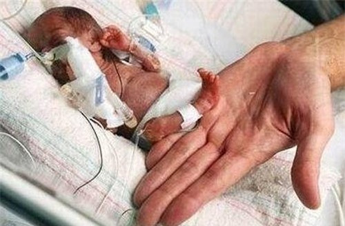 7. Bà mẹ hạ sinh em bé nhỏ nhất: Em bé nhỏ nhất thế giới được chào đời khi chỉ mới 25 tuần tuổi, 6 ngày. Trọng lượng của cô bé còn chưa bằng 1 lon bia. Ngày 19/9/2004 cô Mahajabeen Sheikh đã hạ sinh cô bé Rumaisa Rahman. Trong ngày sinh nhật l tuổi của mình Rumaisa Rahman đã phát triển khá tốt và có cân nặng khoảng 1,2kg. 