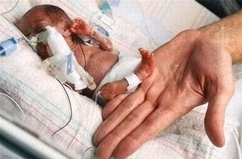 7. Bà mẹ hạ sinh em bé nhỏ nhất: Em bé nhỏ nhất thế giới được chào đời khi chỉ mới 25 tuần tuổi, 6 ngày. Trọng lượng của cô bé còn chưa bằng 1 lon bia. Ngày 19/9/2004 cô Mahajabeen Sheikh đã hạ sinh cô bé Rumaisa Rahman. Trong ngày sinh nhật l tuổi của mình Rumaisa Rahman đã phát triển khá tốt và có cân nặng khoảng 1,2kg. 